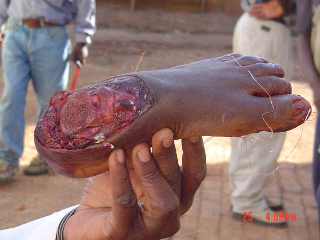 congo-horror-foot.jpg (157169 bytes)